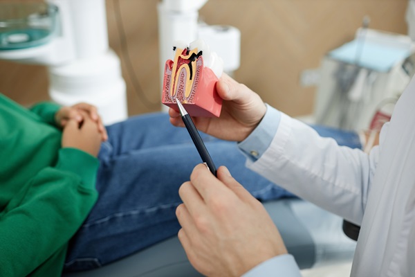 The Number Of Visits Needed For A Root Canal Treatment